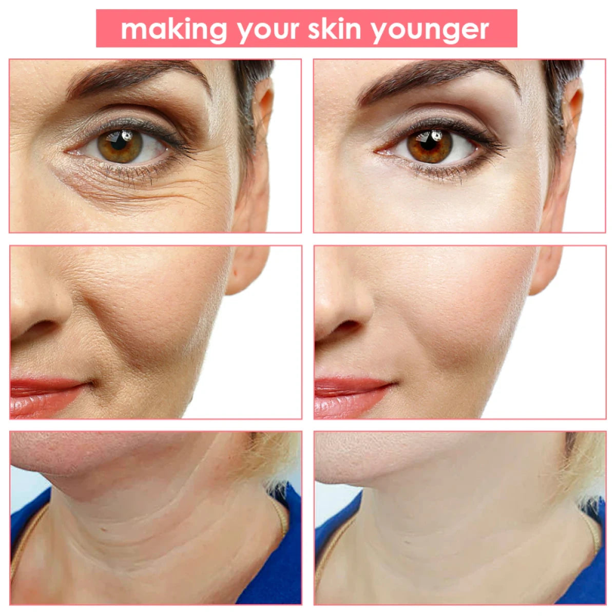 Masajeador Mesoterapia  Facial