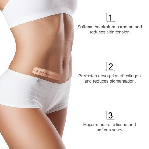 Cinta de silicona 3 metros para cicatrices piel