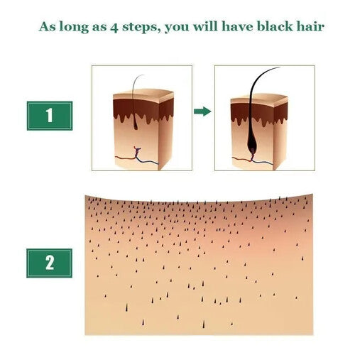 Suero para el Crecimiento del Cabello AntiCaida
