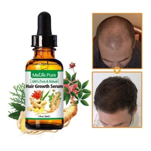Suero para el Crecimiento del Cabello AntiCaida