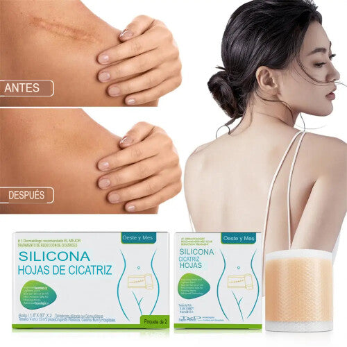 Cinta de silicona de 1.5 metros para cicatrices piel